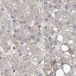 AspRS Antibody in Immunohistochemistry (IHC)