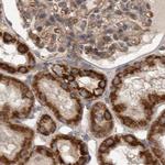 AspRS Antibody in Immunohistochemistry (IHC)