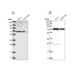 AspRS Antibody in Western Blot (WB)