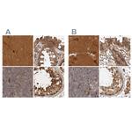 CAMSAP2 Antibody in Immunohistochemistry (IHC)