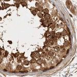 CAMSAP2 Antibody in Immunohistochemistry (IHC)