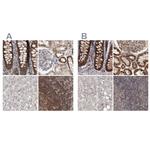 AspRS Antibody in Immunohistochemistry (IHC)