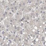 AspRS Antibody in Immunohistochemistry (IHC)