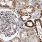 AspRS Antibody in Immunohistochemistry (IHC)