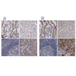 DBT Antibody in Immunohistochemistry (IHC)