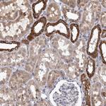 DBT Antibody in Immunohistochemistry (IHC)