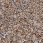 CCBL2 Antibody in Immunohistochemistry (IHC)