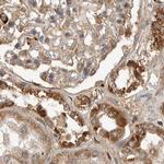 CCBL2 Antibody in Immunohistochemistry (IHC)