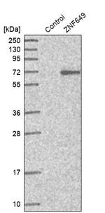 ZNF649 Antibody in Western Blot (WB)