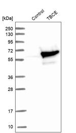 TBCE Antibody in Western Blot (WB)