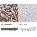 CDH17 Antibody in Immunohistochemistry (IHC)