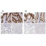 CDH17 Antibody in Immunohistochemistry (IHC)