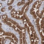 CDH17 Antibody in Immunohistochemistry (IHC)