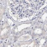 CDH17 Antibody in Immunohistochemistry (IHC)