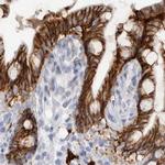 CDH17 Antibody in Immunohistochemistry (IHC)