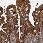 RABGGTB Antibody in Immunohistochemistry (IHC)