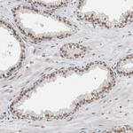 NCAPG2 Antibody in Immunohistochemistry (IHC)