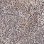 NCAPG2 Antibody in Immunohistochemistry (IHC)