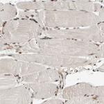 NCAPG2 Antibody in Immunohistochemistry (IHC)