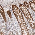 STARD10 Antibody in Immunohistochemistry (IHC)