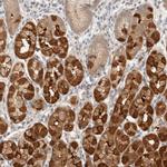 STARD10 Antibody in Immunohistochemistry (IHC)