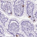 NTS Antibody in Immunohistochemistry (IHC)