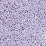 NTS Antibody in Immunohistochemistry (IHC)