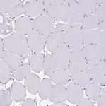 NTS Antibody in Immunohistochemistry (IHC)