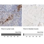 FGL2 Antibody in Immunohistochemistry (IHC)