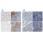 FGL2 Antibody in Immunohistochemistry (IHC)