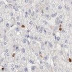 FGL2 Antibody in Immunohistochemistry (IHC)