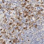 FGL2 Antibody in Immunohistochemistry (IHC)