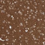 SH3GL2 Antibody in Immunohistochemistry (IHC)