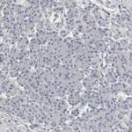 SH3GL2 Antibody in Immunohistochemistry (IHC)