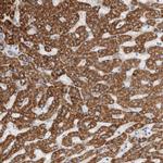 ECHDC2 Antibody in Immunohistochemistry (IHC)