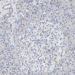 ECHDC2 Antibody in Immunohistochemistry (IHC)