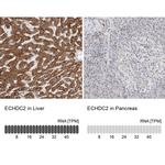 ECHDC2 Antibody in Immunohistochemistry (IHC)