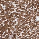 ECHDC2 Antibody in Immunohistochemistry (IHC)