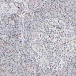 ECHDC2 Antibody in Immunohistochemistry (IHC)