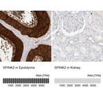 SPINK2 Antibody in Immunohistochemistry (IHC)