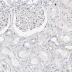 SPINK2 Antibody in Immunohistochemistry (IHC)