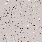 YAF2 Antibody in Immunohistochemistry (IHC)