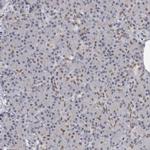 YAF2 Antibody in Immunohistochemistry (IHC)