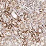 SLC25A26 Antibody in Immunohistochemistry (IHC)