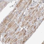 SLC25A26 Antibody in Immunohistochemistry (IHC)