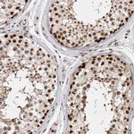 EYA2 Antibody in Immunohistochemistry (IHC)