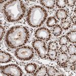 EYA2 Antibody in Immunohistochemistry (IHC)