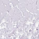 Caspase 14 Antibody in Immunohistochemistry (IHC)