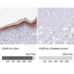 Caspase 14 Antibody