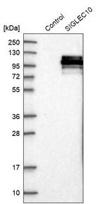 SIGLEC10 Antibody in Western Blot (WB)